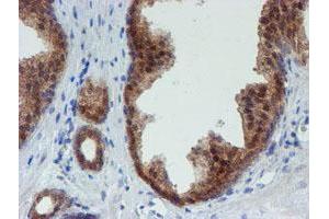 Image no. 9 for anti-Mannose Phosphate Isomerase (MPI) antibody (ABIN1499545) (MPI Antikörper)