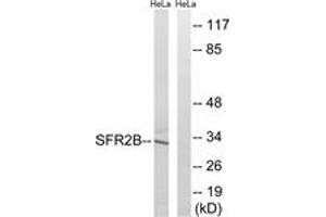Western Blotting (WB) image for anti-serine/arginine-Rich Splicing Factor 8 (SRSF8) (AA 31-80) antibody (ABIN2890655) (SFRS2B Antikörper  (AA 31-80))