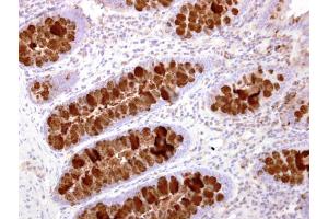 IHC-P Image IL16 antibody [C3], C-term detects IL16 protein at secreted on human normal colon by immunohistochemical analysis.