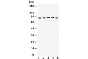 Western blot testing of 1) rat brain, 2) rat testis, 3) human HeLa, 4) SKOV and 5) SW620 lysate with EWSR1 antibody. (EWSR1 Antikörper)