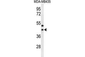 Western blot analysis of GPR17 (arrow) in MDA-MB435 cell line lysates (35ug/lane) using GPR17 (GPR17 Antikörper  (Middle Region))