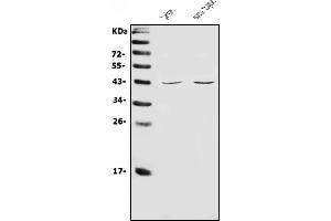 Western blot analysis of CD48 using anti-CD48 antibody (ABIN7600998).