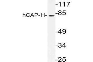 Western blot (WB) analysis of hCAP-H antibody in extracts from K562 cells. (NCAPH Antikörper)