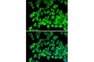 Immunofluorescence analysis of MCF7 cells using RPL13 antibody (ABIN1682571, ABIN5664631, ABIN5664633 and ABIN6220492). (RPL13 Antikörper  (AA 1-211))