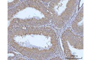 IHC analysis of OCRL using anti-OCRL antibody (ABIN7599572). (OCRL Antikörper  (AA 1-901))