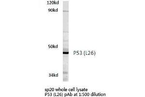 Western blot (WB) analyzes of P53 antibody in extracts from SP20 cells. (p53 Antikörper)