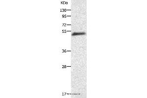 Western blot analysis of Human liver cancer tissue, using AGT Polyclonal Antibody at dilution of 1:200 (AGT Antikörper)