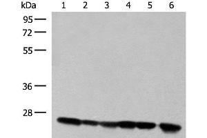 Western blot analysis of 293T cell and Human fetal liver tissue lysates using DTYMK Polyclonal Antibody at dilution of 1:550