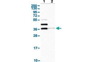 Western Blot analysis with SLAMF6 polyclonal antibody . (SLAMF6 Antikörper  (AA 152-224))