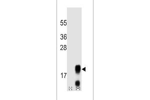 Western blot analysis of FSHB/FSH (arrow) using mouse polyclonal FSHB/FSH antibody (Center) (ABIN658910 and ABIN2837836).
