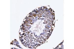 IHC analysis of KIFC1 using anti-KIFC1 antibody (ABIN7599523). (KIFC1 Antikörper  (AA 1-673))