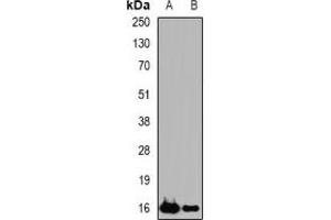 Western blot analysis of sPLA2-IID expression in Hela (A), THP1 (B) whole cell lysates.