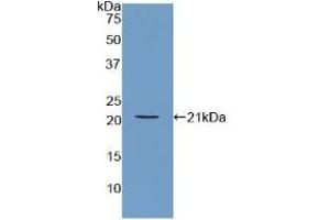 Detection of Recombinant ARPC4, Human using Polyclonal Antibody to Actin Related Protein 2/3 Complex Subunit 4 (ARPC4) (ARPC4 Antikörper  (AA 3-165))