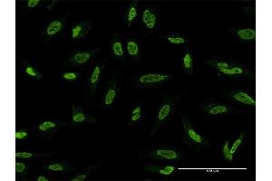 Immunofluorescence of monoclonal antibody to STK24 on HeLa cell. (STK24 Antikörper  (AA 1-431))