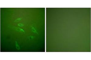 Immunofluorescence analysis of HeLa cells, using Collagen Type III antibody.