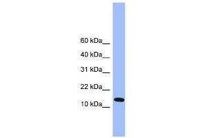 WB Suggested Anti-Atp5d Antibody Titration: 0. (ATP5F1D Antikörper  (C-Term))