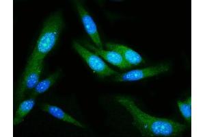 IF analysis of GSDMD using anti-GSDMD antibody (ABIN7599433). (GSDMD Antikörper  (AA 1-484))