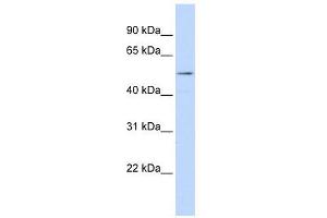 WB Suggested Anti-SUV420H1 AntibodyTitration: 1. (SUV420H1 Antikörper  (Middle Region))