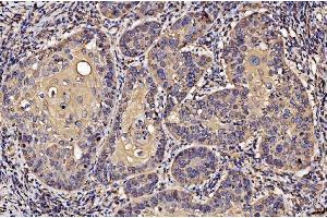 IHC analysis of PDIA6 using anti-PDIA6 antibody (ABIN7600554). (PDIA6 Antikörper  (AA 20-440))