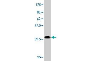 Western Blot detection against Immunogen (37. (FBLIM1 Antikörper  (AA 270-373))