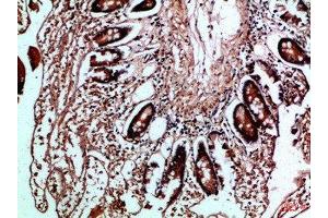 Immunohistochemical analysis of paraffin-embedded Human-colon, antibody was diluted at 1:100 (HLA-DMB Antikörper  (AA 40-100))