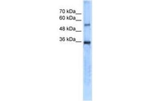 Image no. 1 for anti-Carbonic Anhydrase VIII (CA8) (AA 31-80) antibody (ABIN204988) (CA8 Antikörper  (AA 31-80))