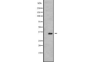 Western blot analysis of TSSK3 expression in A431 whole cell lysate ,The lane on the left is treated with the antigen-specific peptide. (TSSK3 Antikörper  (N-Term))