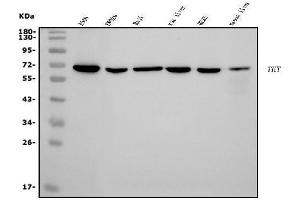 Western blot analysis of Transketolase/TKT using anti-Transketolase/TKT antibody (ABIN7598957).