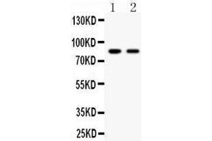 Anti- Mitofusin-2 Picoband antibody, Western blotting All lanes: Anti Mitofusin-2  at 0. (MFN2 Antikörper  (AA 601-757))