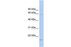 WB Suggested Anti-GK Antibody Titration: 0. (Glycerol Kinase Antikörper  (Middle Region))