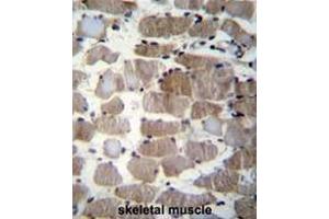 Formalin fixed and paraffin embedded human skeletal muscle stained with CTSK Antibody (Center) followed by peroxidase conjugation of the secondary antibody and DAB staining. (Cathepsin K Antikörper  (Middle Region))