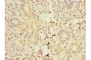 Immunohistochemistry of paraffin-embedded human pancreatic tissue using ABIN7153583 at dilution of 1:100 (GDAP1L1 Antikörper  (AA 101-260))