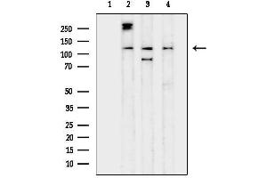 Western blot analysis of lysates from various samples, using iNOS Antibody.