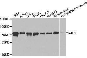 Western blot analysis of extracts of various cell lines, using RAF1 antibody (ABIN5970053) at 1/1000 dilution. (RAF1 Antikörper  (C-Term))