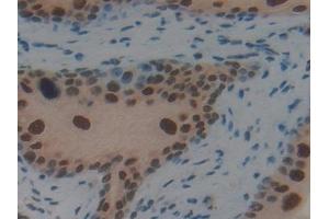 Immunohistochemistry (IHC) image for anti-Interferon Regulatory Factor 2 (IRF2) (AA 1-349) antibody (ABIN7442543)