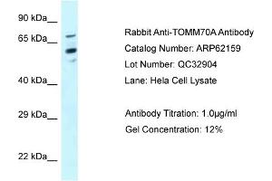 Western Blotting (WB) image for anti-Translocase of Outer Mitochondrial Membrane 70 (TOMM70A) (N-Term) antibody (ABIN786547) (TOM70 Antikörper  (N-Term))