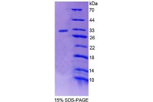 SDS-PAGE analysis of Human PTPN3 Protein. (PTPN3 Protein)