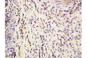 Formalin-fixed and paraffin embedded mouse intestine labeled with Anti-IL-3 Polyclonal Antibody, Unconjugated  at 1:200 followed by conjugation to the secondary antibody and DAB staining. (IL-3 Antikörper  (AA 101-166))