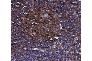 IHC analysis of KLHL12 using anti-KLHL12 antibody (ABIN7601009).