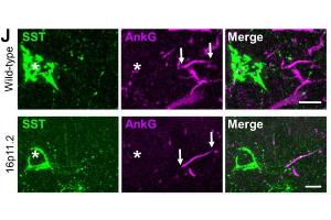 Representative micrographs showing immunohistochemical labelling for SSt (green), the AIS marker AnkyrinG (AnkG, magenta, cat. (Ankyrin G Antikörper)