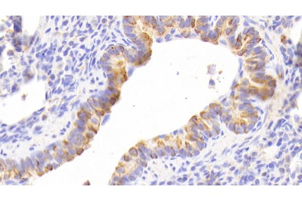 Cytokeratin 13 Antikörper  (AA 104-403)