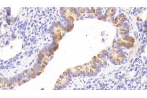 Detection of CK13 in Human Lung Tissue using Polyclonal Antibody to Cytokeratin 13 (CK13) (Cytokeratin 13 Antikörper  (AA 104-403))