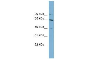 WB Suggested Anti-KRT84 Antibody Titration: 0. (Keratin 84 Antikörper  (Middle Region))