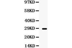 Observed bind size: 28KD (Mip (AA 232-263), (C-Term) Antikörper)