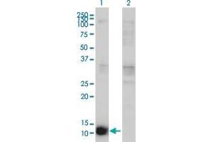 Lane 1: CSTB transfected lysate ( 11 KDa). (CSTB HEK293 Cell Transient Overexpression Lysate(Non-Denatured))