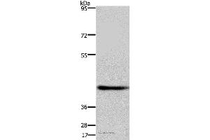Western blot analysis of Human fetal brain tissue, using DRG1 Polyclonal Antibody at dilution of 1:500 (DRG1 Antikörper)