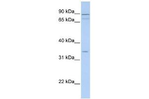 Tenomodulin antibody used at 1 ug/ml to detect target protein. (TNMD Antikörper  (Middle Region))