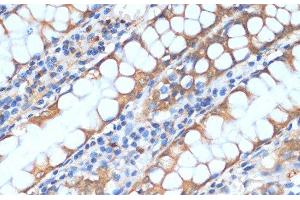 Immunohistochemistry of paraffin-embedded Human colon using HHLA2 Polyclonal Antibody at dilution of 1:100 (40x lens). (HHLA2 Antikörper)