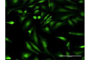 Immunofluorescence of monoclonal antibody to HGD on HeLa cell. (HGD Antikörper  (AA 377-445))