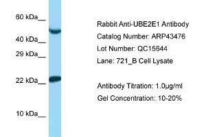 Western Blotting (WB) image for anti-Ubiquitin-Conjugating Enzyme E2E 1 (UBE2E1) (N-Term) antibody (ABIN2781284) (UBE2E1 Antikörper  (N-Term))